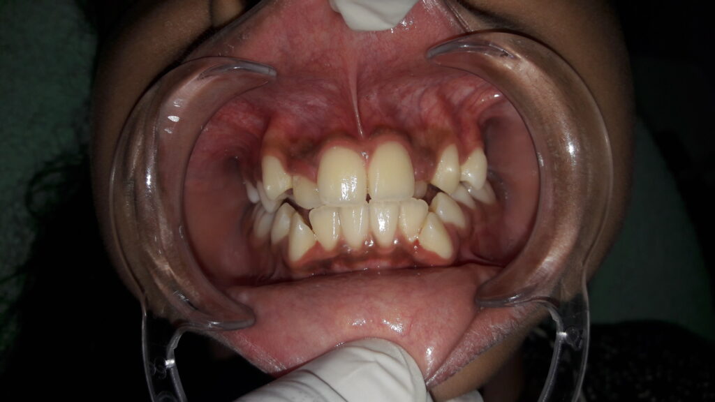 before treatrment image