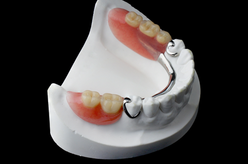 partial denture in coimbatore