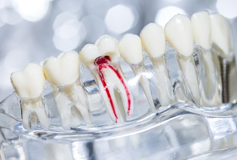 Root Canal Recovery: Complete Timeline and Aftercare Guide