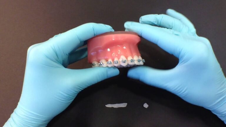 Orthodontic Wax: The Complete Guide to Protecting Your Braces (With Expert Tips)