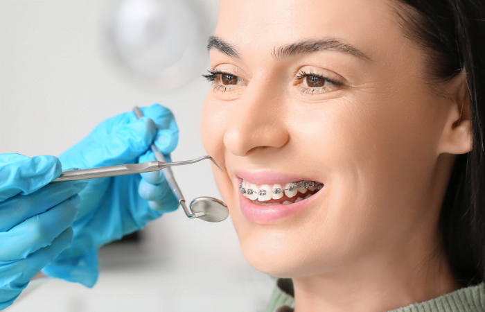 Understanding Orthodontic Treatment: Timeline, Process, and What to Expect