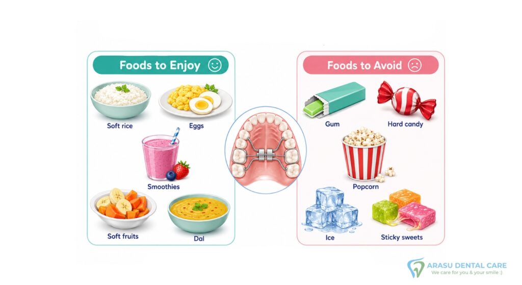 Foods to avoid & Foods to enjoy after a palatal expander treatment