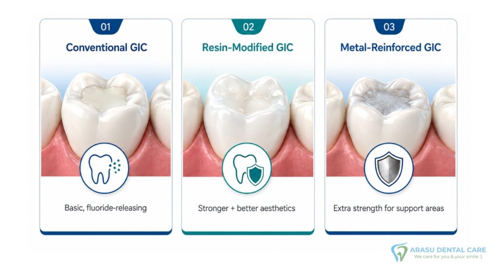 Types of Glass Ionomer Fillings