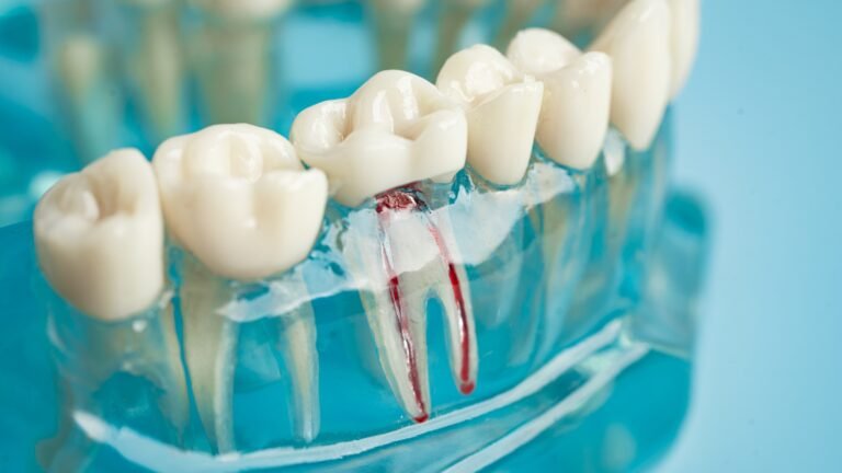 Understanding Re root canal treatment :Cost and Benefits
