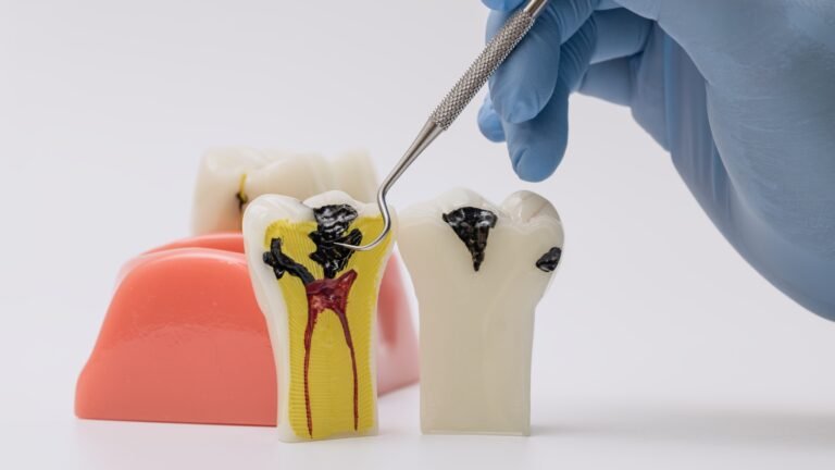 What is a Pulpotomy? A Complete Overview