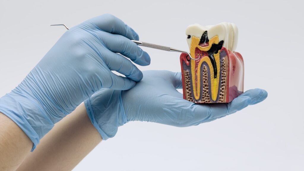 Why Root Canal Re-Treatment Is Necessary?