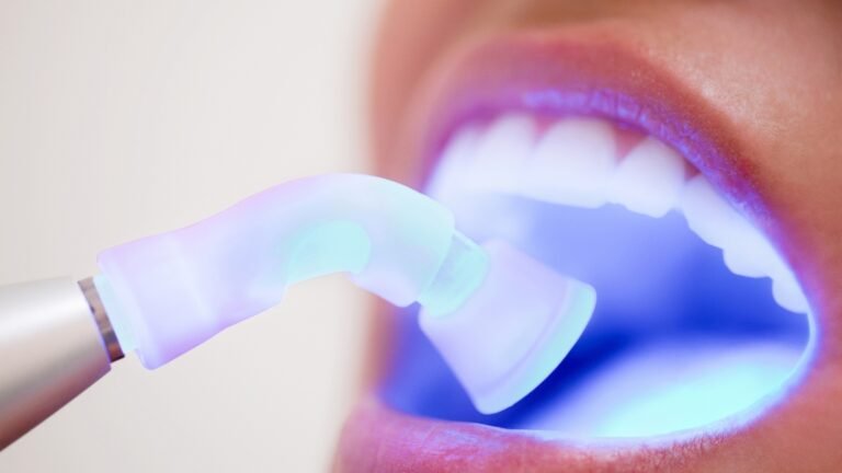 Advantages of Glass Ionomer Filling: A Complete Guide for Patients