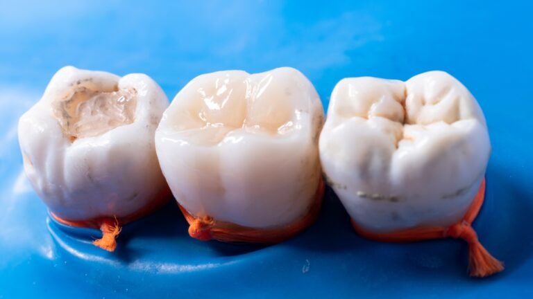 What is Composite dental filling? Benefits and Procedure Explained
