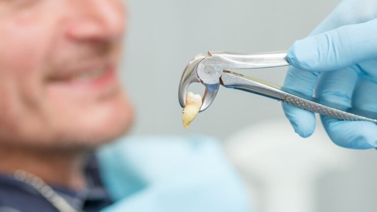Non surgical tooth extraction : Techniques used