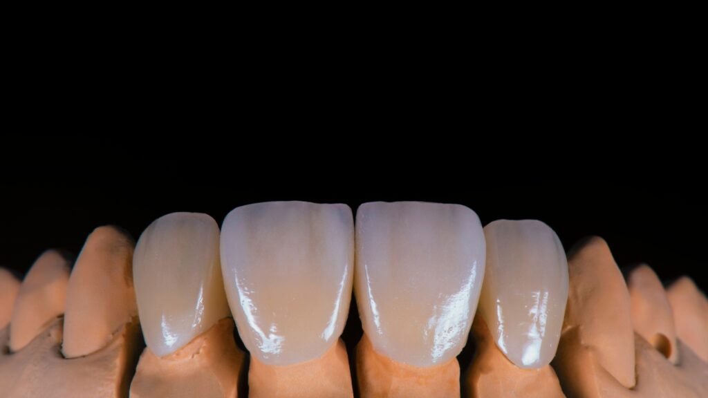 Permanent Ceramic Crown Procedure Explained