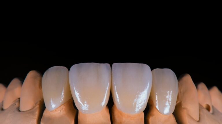 Permanent Ceramic Crown Procedure Explained
