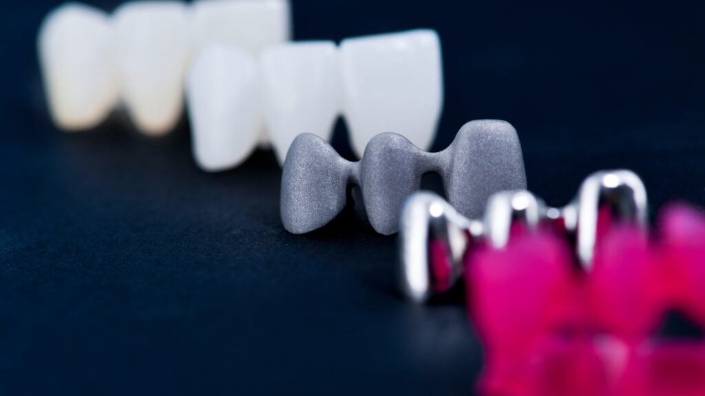 Types of metal dental Crowns in Dentistry