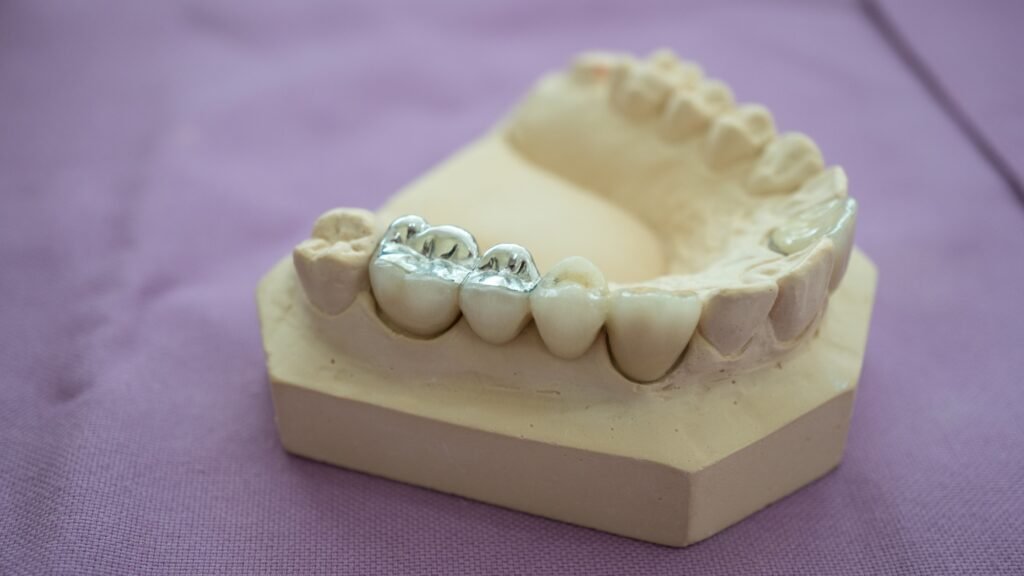 Understanding Amalgam Filling: Procedure, Benefits, and What to Expect