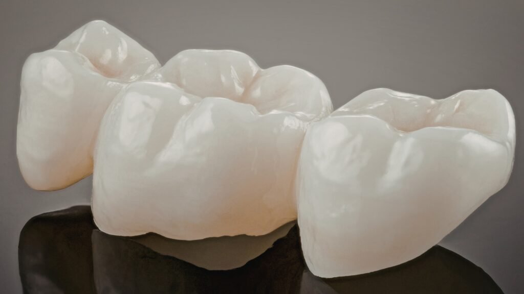White filling in Dentistry :Cost and Benefits