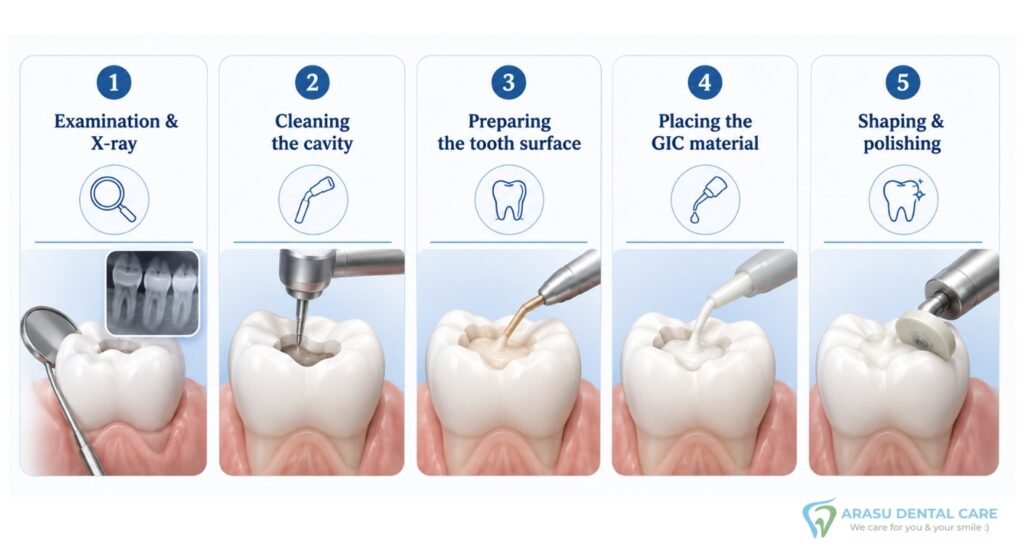 Glass Ionomer Filling Procedure