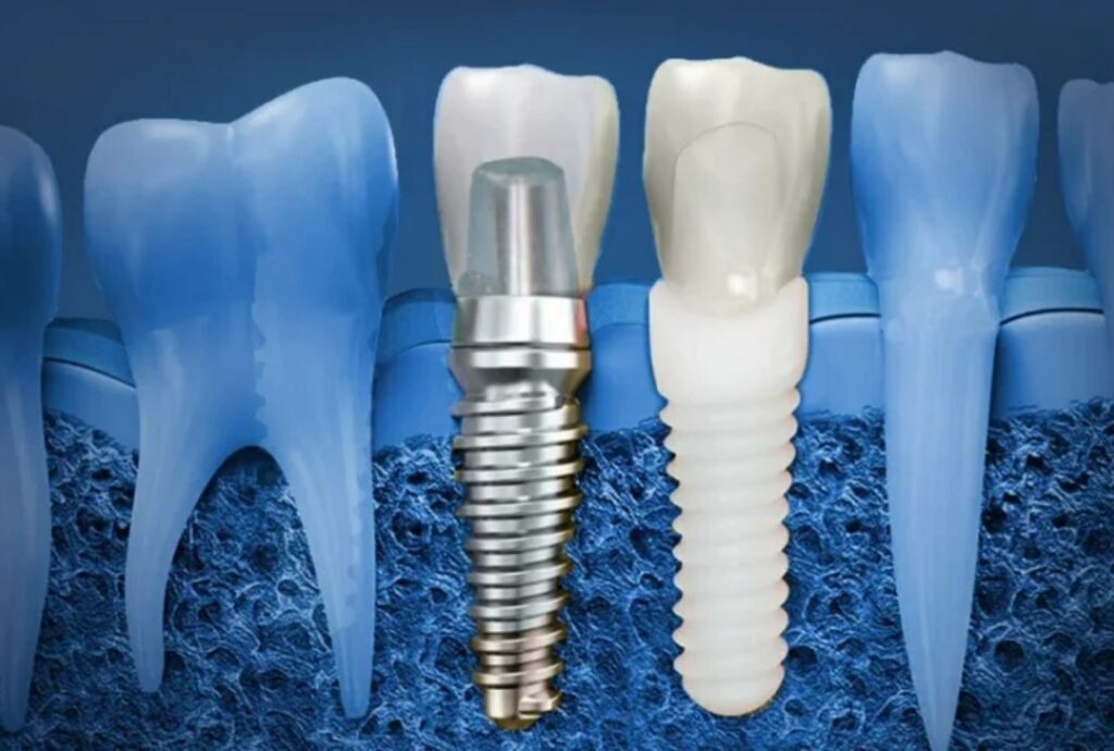 Who Is a Good Candidate for Smile Enhancement?
