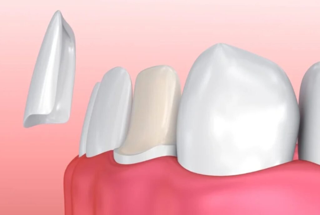 Why More Adults Are Choosing Cosmetic Dentistry