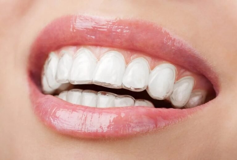 Smile Designing vs Smile Makeover: What’s the Difference?
