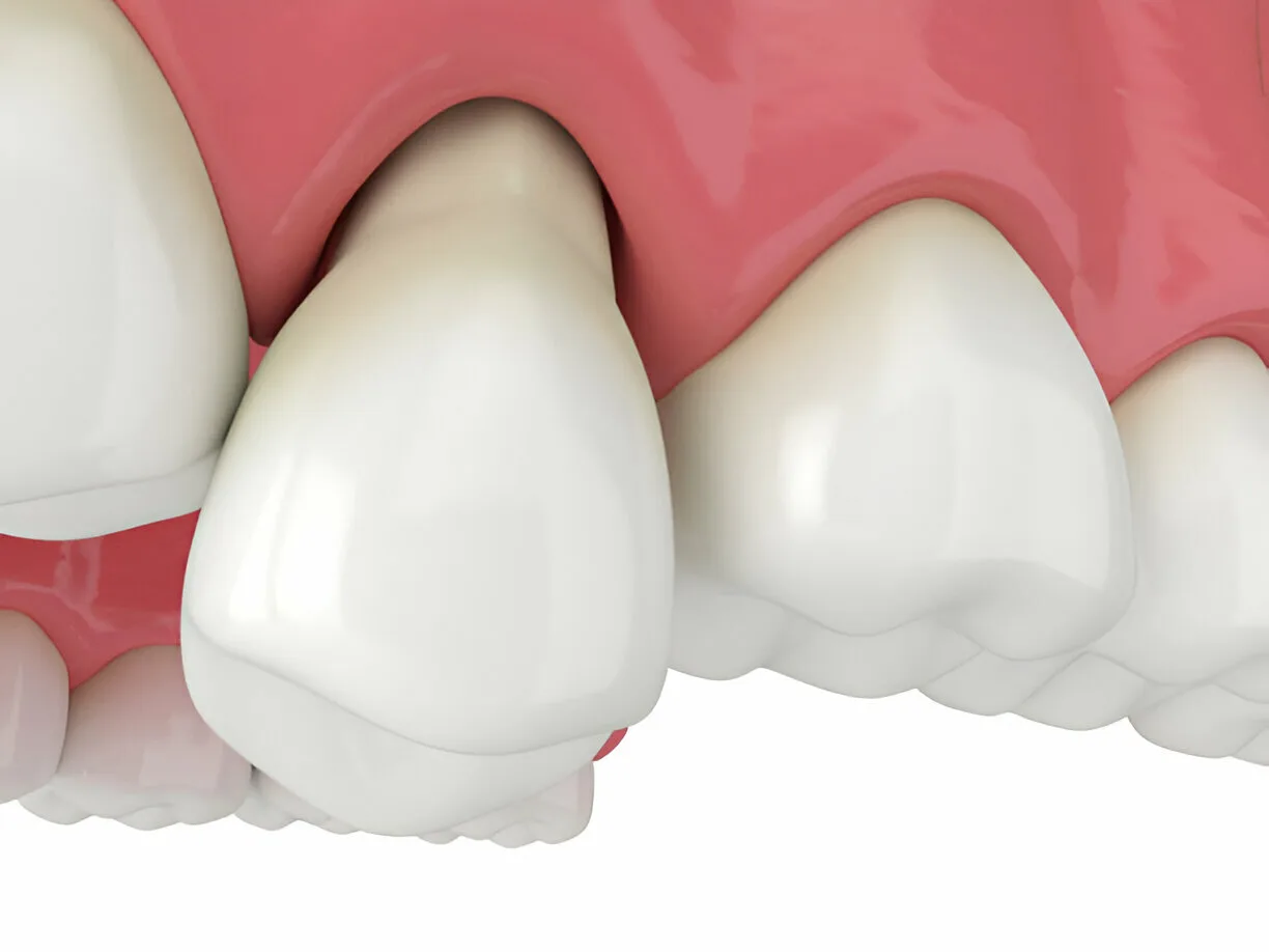 Dentist at Arasu Dental Care, Coimbatore, examining a patient's loose tooth and gum support