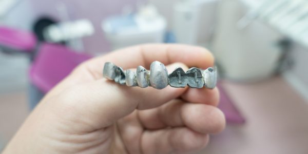 Metal Dental Bridge