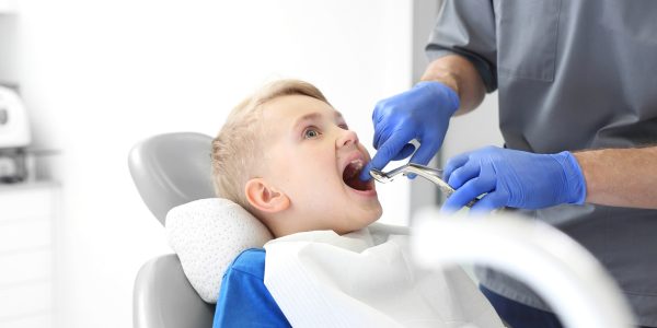 Surgical Extraction of Tooth