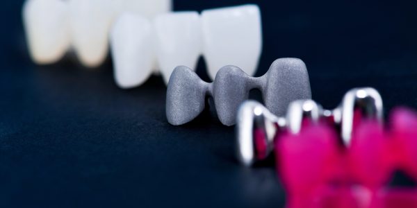 Types of Metal Dental Crowns (1)