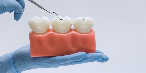 Understanding Pulpotomy Treatment