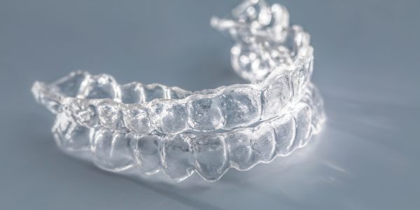 What Are Retainers