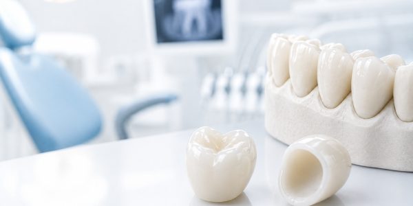 Zirconia Caps for teeth Pros and Cons